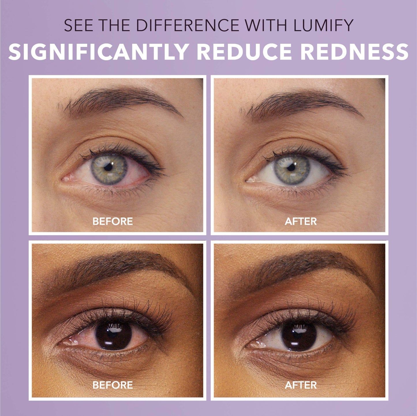 LUMIFY Eye Drops for Red Eyes, Redness Reliever for Brighter Looking Eyes, Works in 1 Minute & Lasts Up to 8 Hours, Eye Drops, 0.25 Fl Oz (7.5mL) LUMIFY buy supplements Au