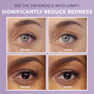 LUMIFY Eye Drops for Red Eyes, Redness Reliever for Brighter Looking Eyes, Works in 1 Minute & Lasts Up to 8 Hours, Eye Drops, 0.25 Fl Oz (7.5mL) LUMIFY buy supplements Au