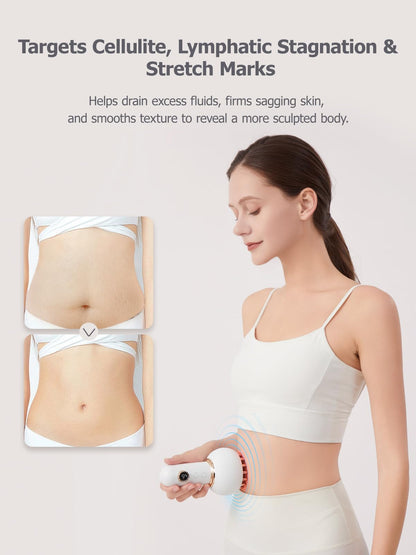 FEEOLA Lymphatic Drainage Massager & Cellulite Massage Tool, Helps Reduce Stretch Marks & Cellulite, for Legs, Arms & Belly, Body Sculpting Machine with Microcurrent, Light, Heat & Vibration FEEOLA buy supplements Au