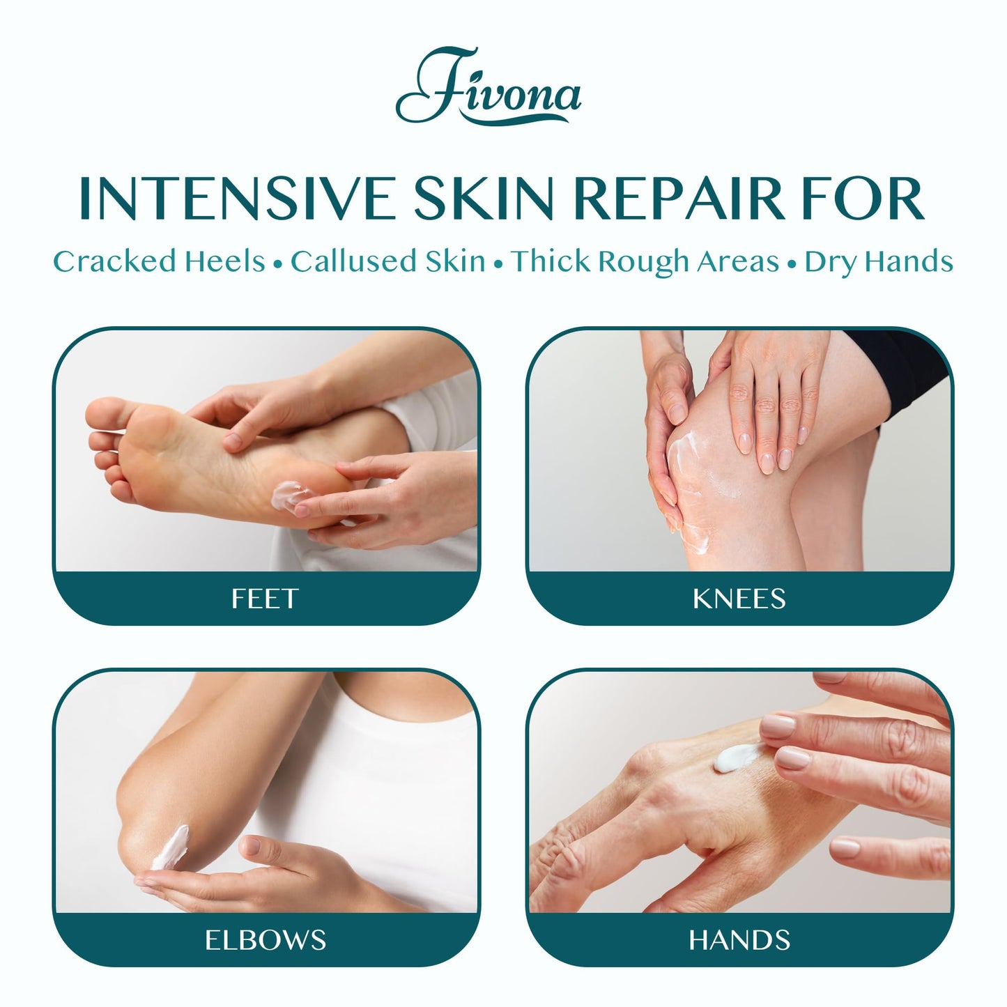 FIVONA 42% Urea Foot Cream for Thick, Rough Dry Skin - Maximum Strength Callus Softening with 2% Salicylic Acid, Tea Tree & Aloe Vera, 100g (3.5 oz) - Deep Moisturizing Foot Care