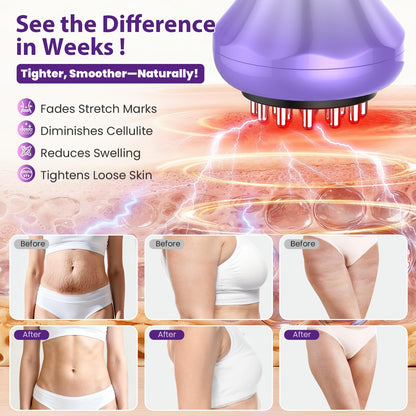 Lymphatic Drainage Massager, Anti Cellulite Massage Tool For Thigh & Belly Stretch Marks & Cellulite Reduction, Handheld Massage tools for Sciatica Nerve, Legs, Arms, Hip, Muscle, Low Back Pain Relief AIHEU buy supplements Au
