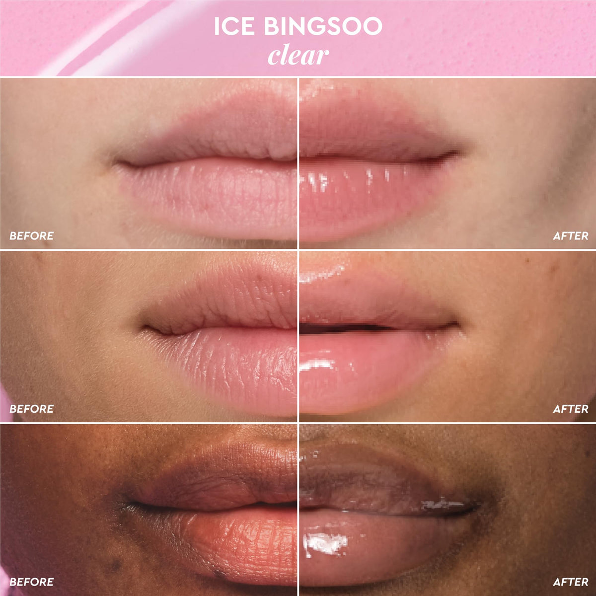 Glow Recipe Glass Balm Lip Treatment - 12Hr Hydrating Lip Balm & Moisturizer with Hyaluronic Acid to Smooth, Plump & Protect from Dryness, High Shine Finish - Clear Tint, Ice Bingsoo (15 ml) Glow RecipeBuy Supplements Australia