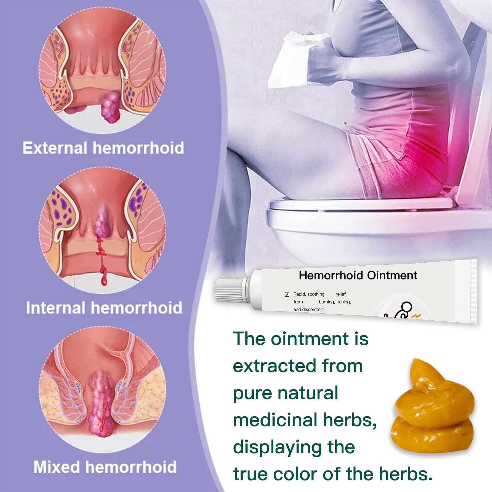 BXQJRJ Hemorrhoid Ointment,Herbal hemorrhoid Gel,Effectively relieves Anal discomfort,Suitable for Men and Women,Fast-Acting hemorrhoid Ointment (20g) BXQJRJBuy Supplements Australia
