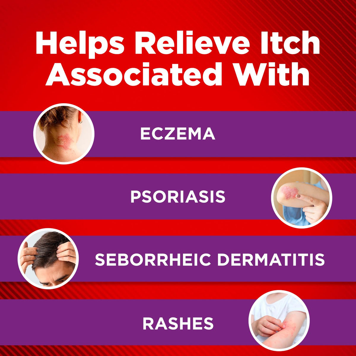 Cortizone-10 Maximum Strength Intensive Healing Itch Relief Lotion for Eczema, 1% Hydrocortisone, Fast-Acting, Anti-Itch Cream for Minor Skin Irritations, Rashes and Inflammation Due to Eczema, 3.5 oz Cortizone 10 buy supplements Au