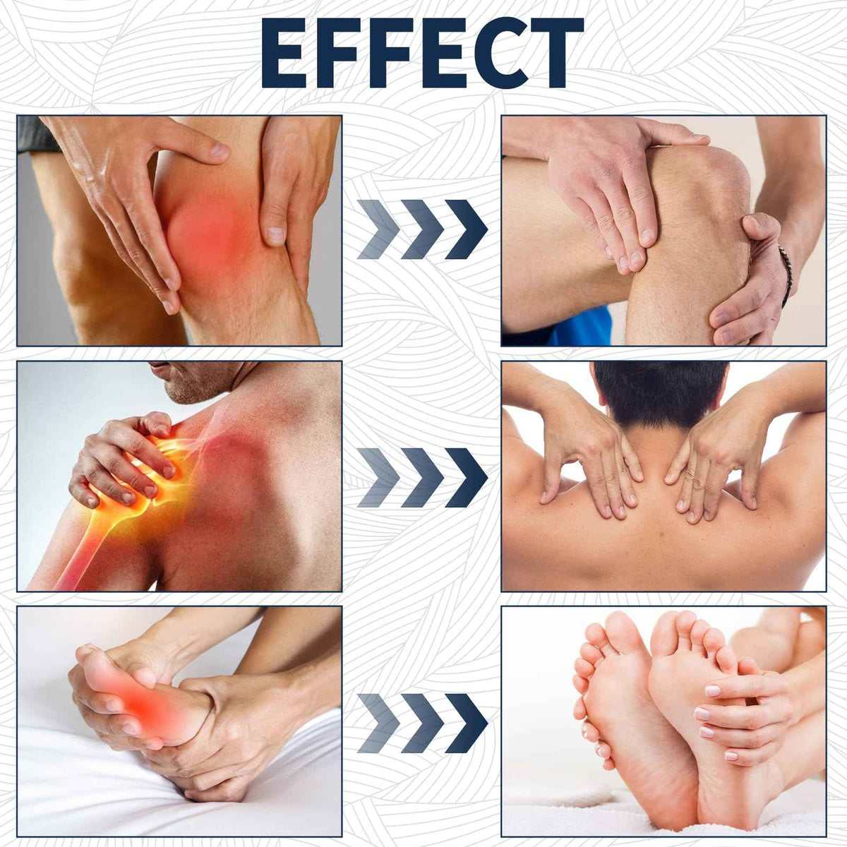 YIVANNUO 2PCS Neuropathy Relief Cream, Contains Arnica, Menthol, Msm, and Glucosamine, Suitable for Feet, Hands, Legs, Muscles, Joints, and Waist, Fast Absorption, Mild & All Natural