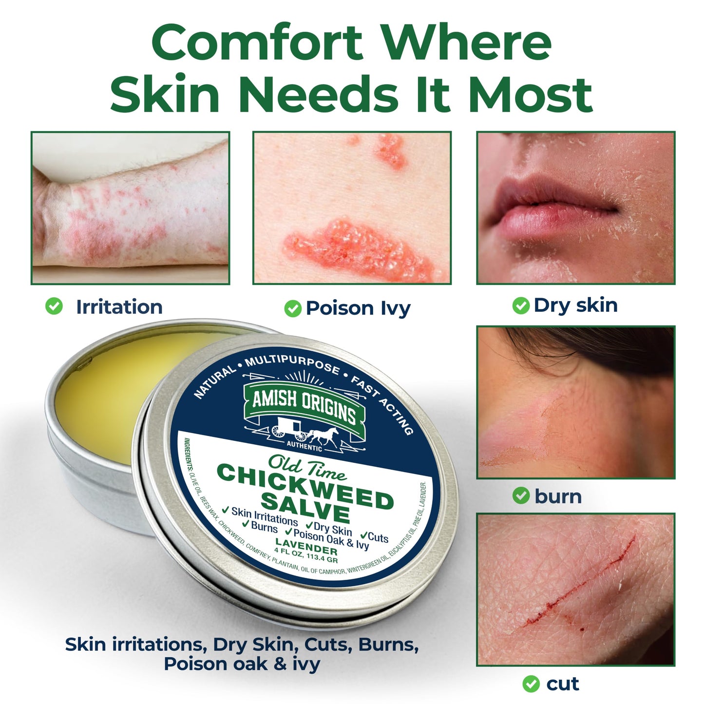 Amish Origins Old Time Chickweed Salve 2 oz- The Ultimate Poison Ivy/Poison Oak Blocker, Healing Salve for Skin Disorder, Irritations, Burns, Minor Cuts