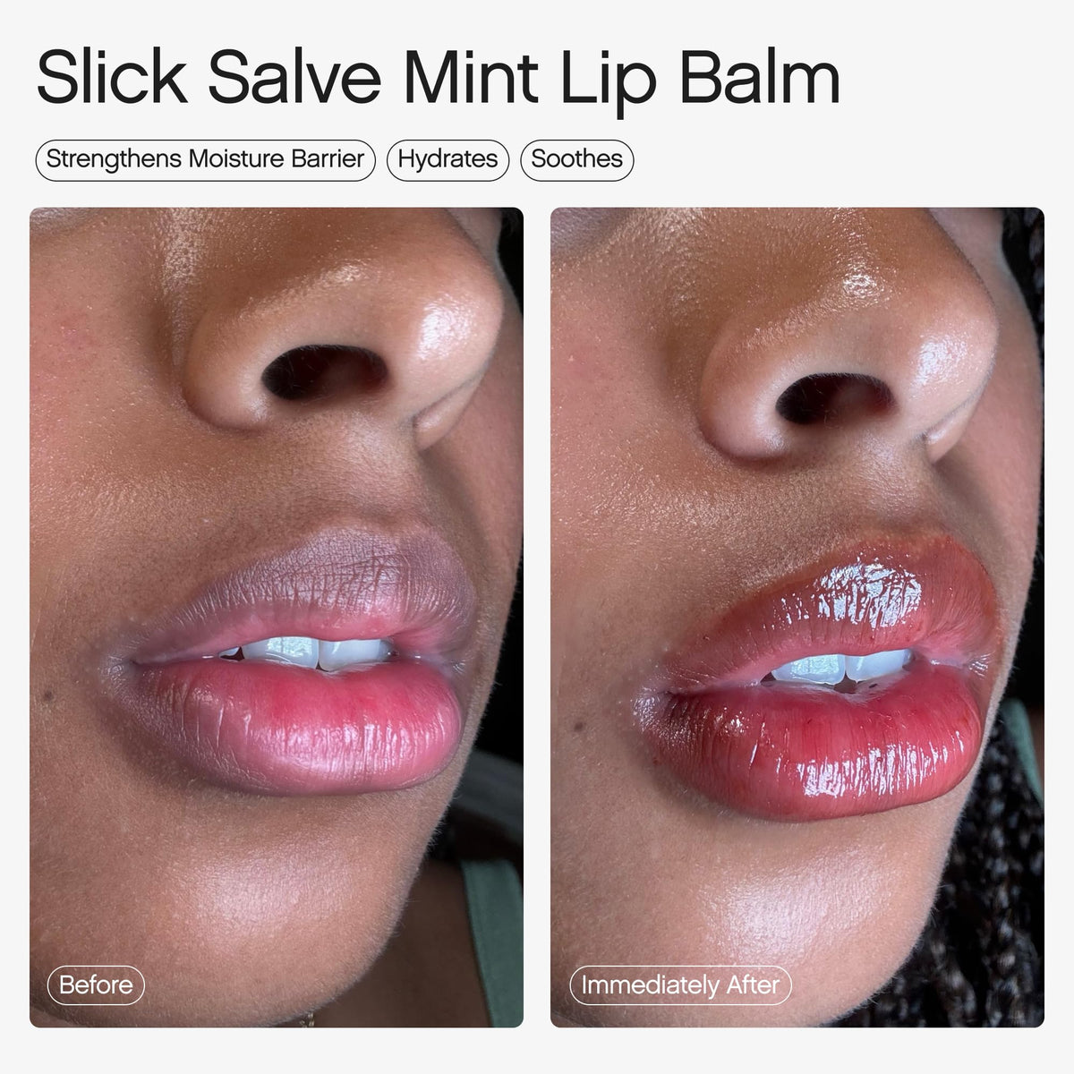 Topicals Slick Salve Mint Glossy Lip Balm | Soothes Discomfort, Strengthens Barrier and Provides Lasting Hydration & Relief | Vegan, Paraben-Free