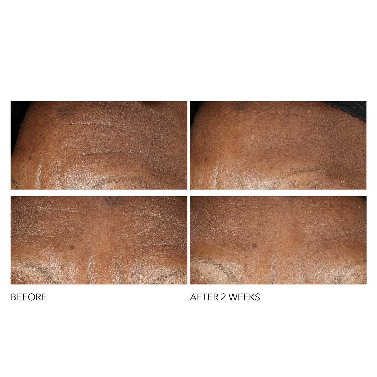 Dr Dennis Gross Advanced Retinol + Ferulic Intense Wrinkle Cream | Intensely Hydrating to Visibly Transform Skin and Repair the Moisture Barrier | 2 oz Dr Dennis GrossBuy Supplements Australia