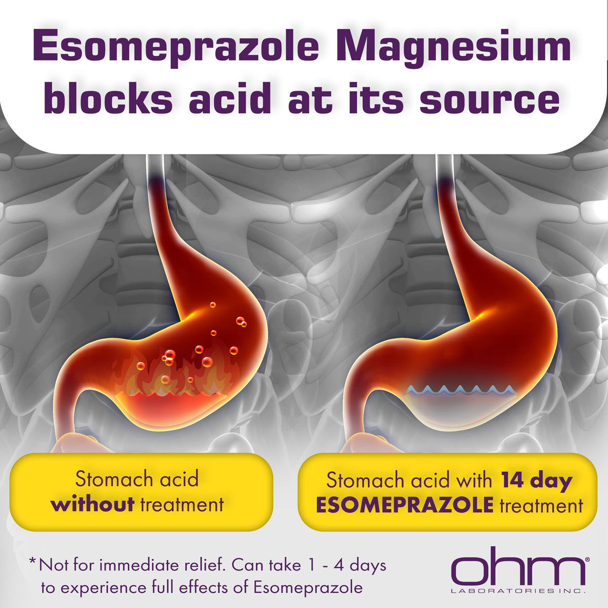 Ohm Esomeprazole Magnesium Delayed Release Capsules 20mg - Frequent Heartburn & Acid Reflux Relief, 24 Hour Chest & Stomach Acid Reducer (6 Weeks of Supply, 42, Count) Ohm buy supplements Au