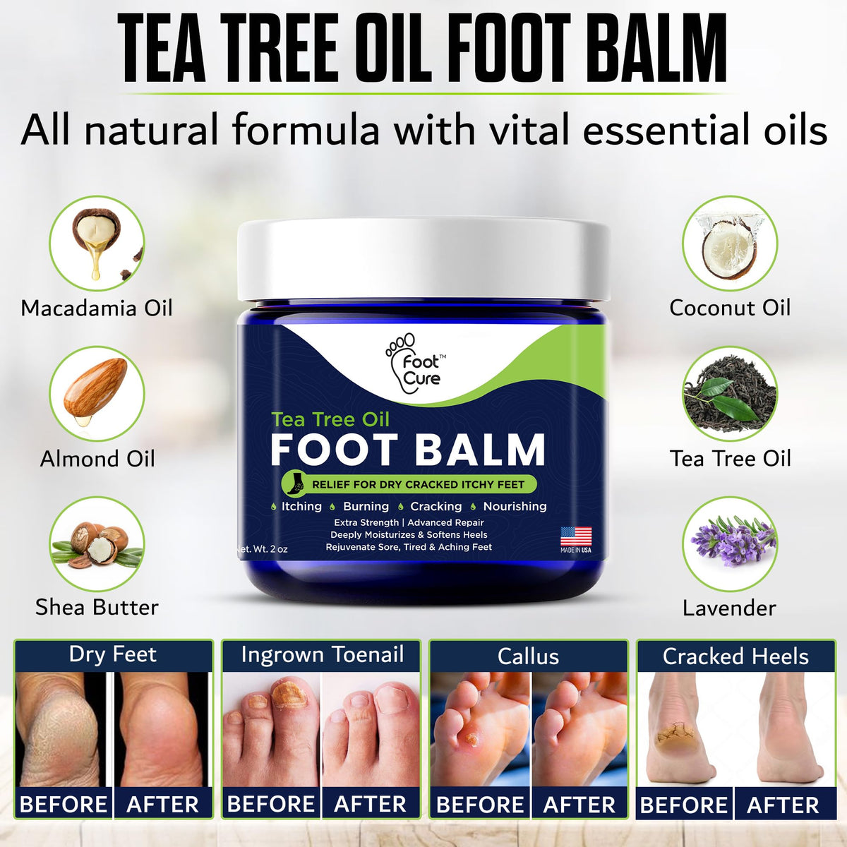 FOOT CURE Tea Tree Oil Balm – Moisturizer for Dry Cracked Feet – Instantly Hydrates & Soothes Irritated Skin & Athlete's Foot – Best Foot Care for Women and Men (Pack of 2) FOOT CURE buy supplements Au