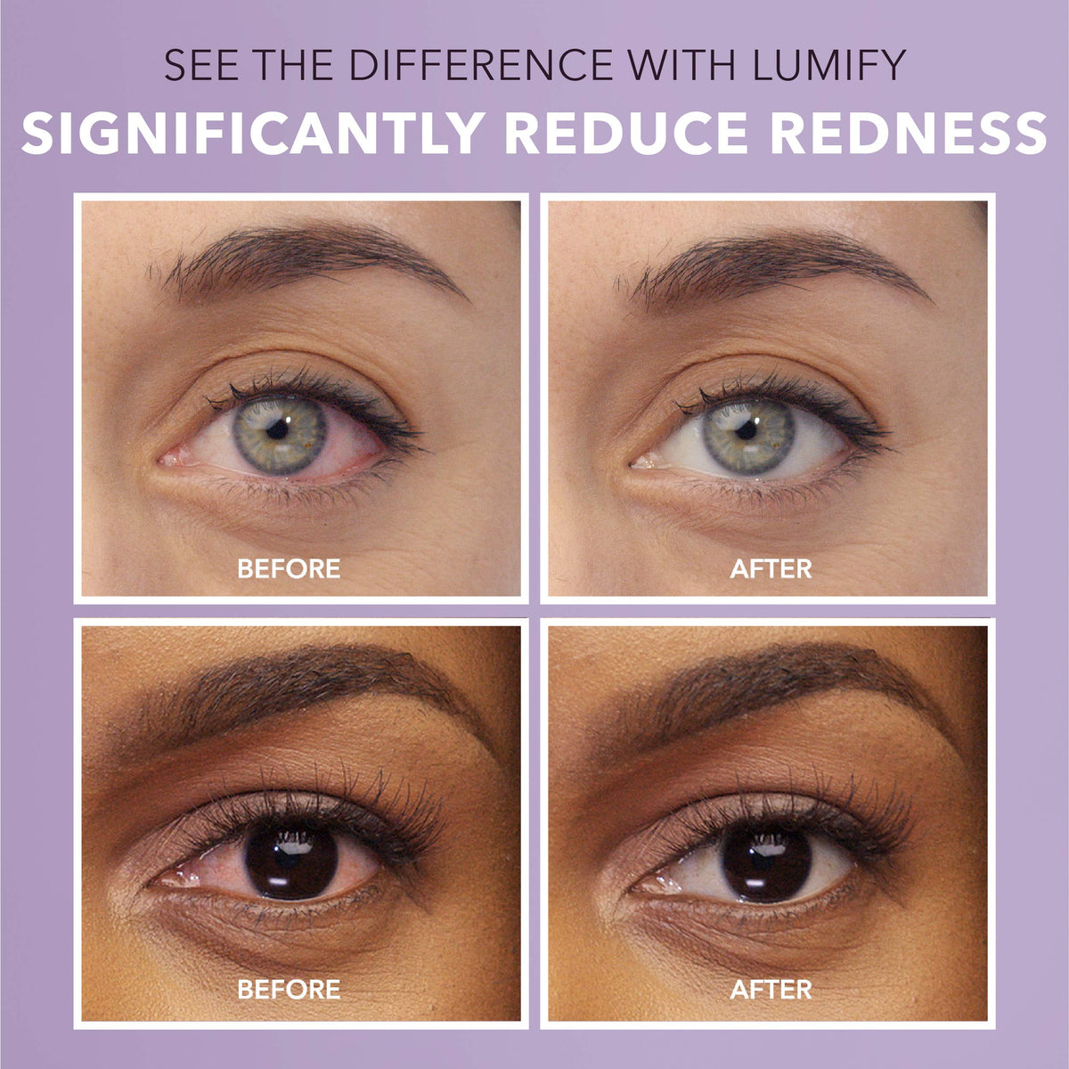 LUMIFY Eye Drops for Red Eyes, Redness Reliever for Brighter Looking Eyes, Works in 1 Minute & Lasts Up to 8 Hours, Eye Drops, 0.25 Fl Oz (7.5mL) LUMIFY buy supplements Au