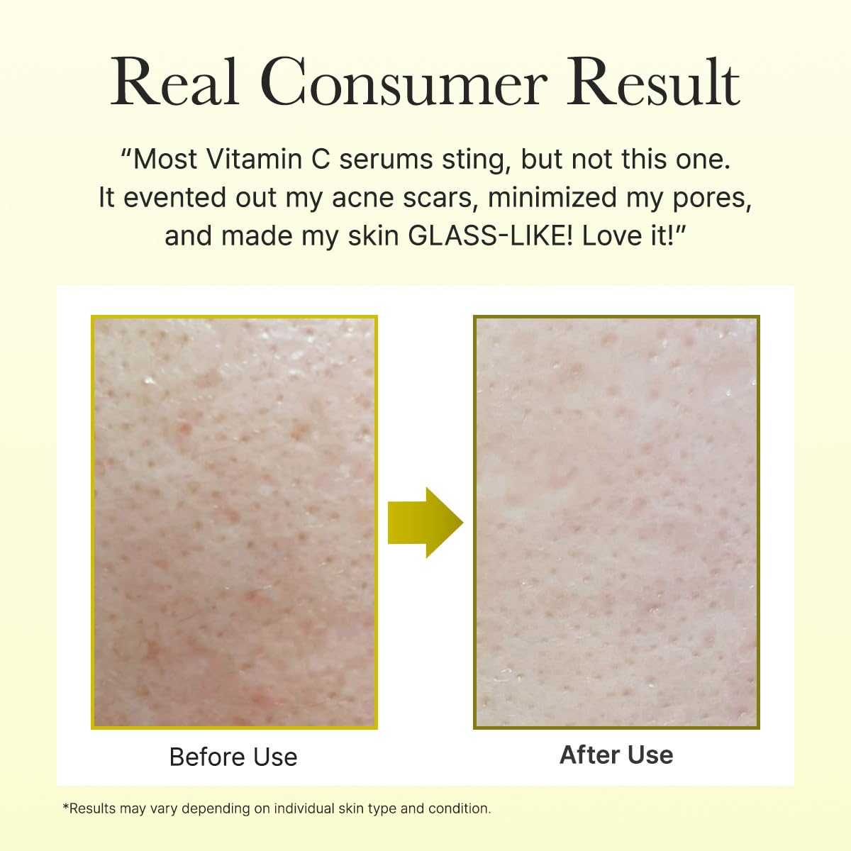 Arencia Vitamin C Booster Shot Serum with Glutathione, Niacinamide and Vitamin E for Dark Spot Care, Fine Lines & Wrinkles - PrimeBioHealth - canada supplements
