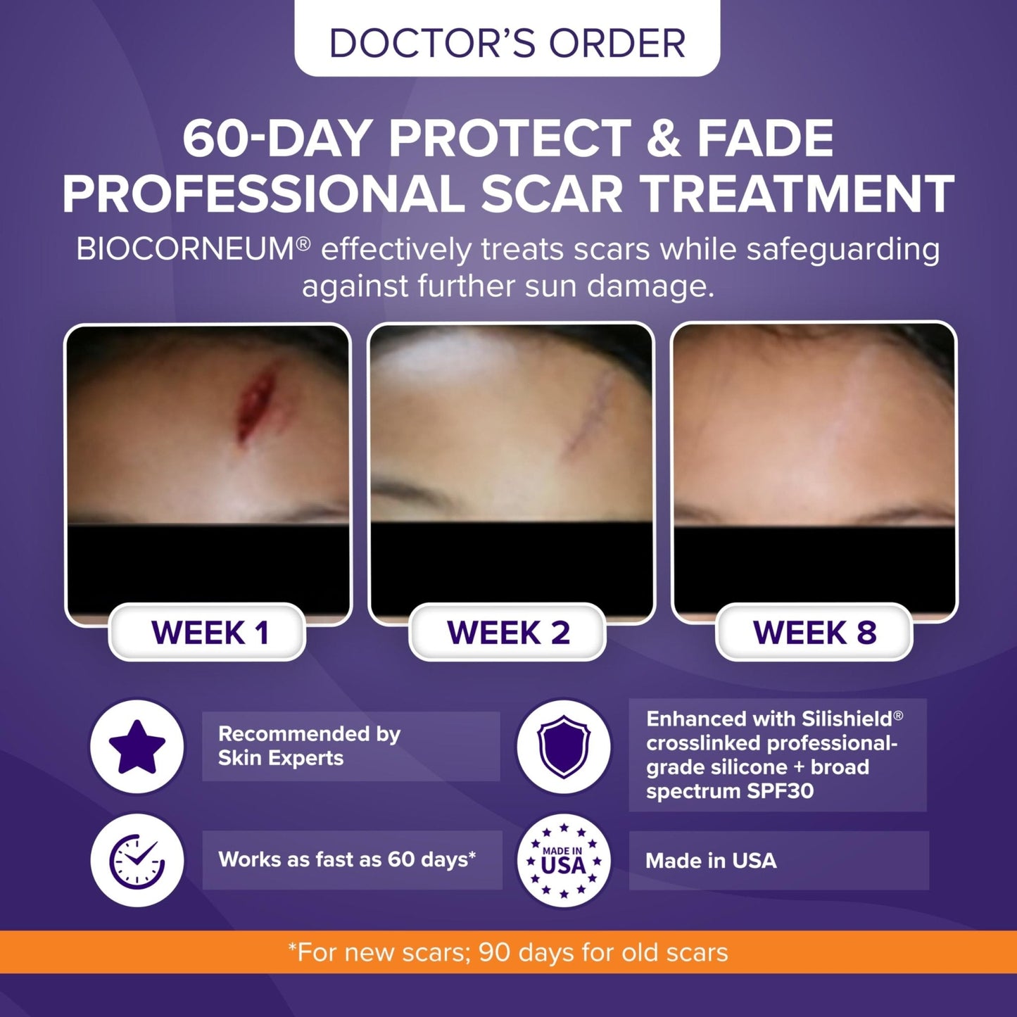 Biocorneum Advanced Scar Treatment with Silishield® & SPF 30 10g – Medical Grade Silicone Gel to Support Healing of Surgical Scars and Marks - PrimeBioHealth - canada supplements