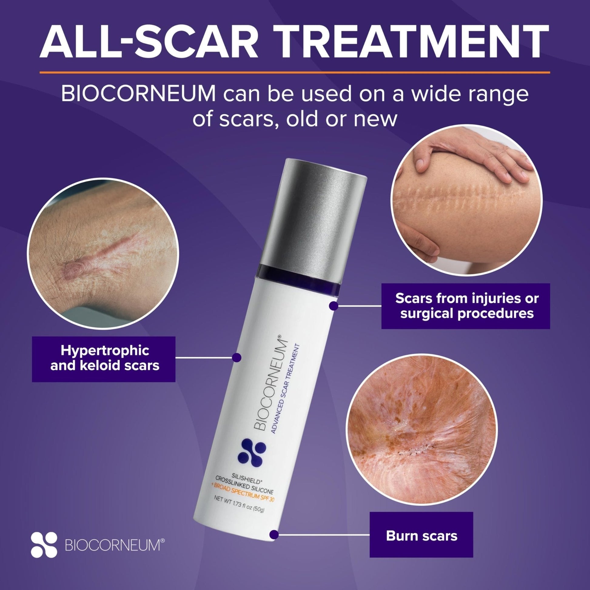 Biocorneum Advanced Scar Treatment with Silishield® & SPF 30 10g – Medical Grade Silicone Gel to Support Healing of Surgical Scars and Marks - PrimeBioHealth - canada supplements