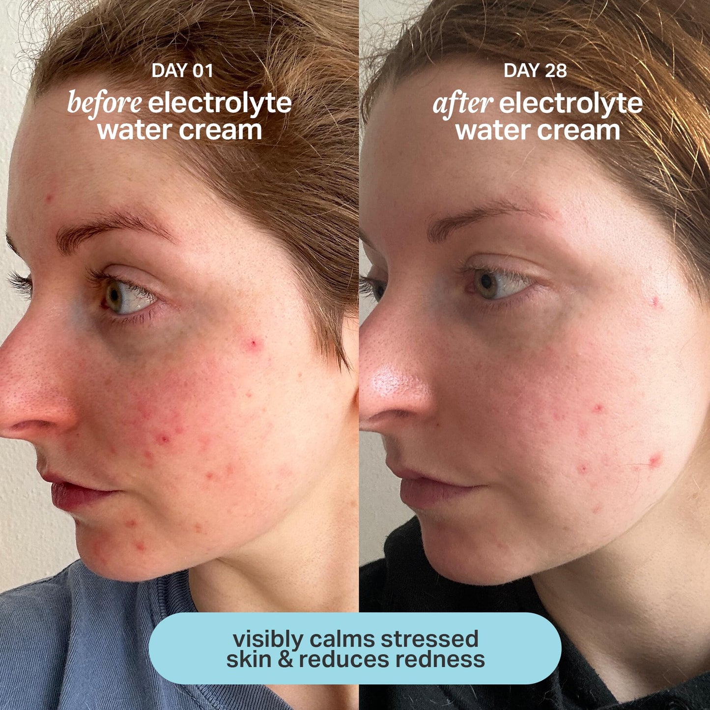 Cocokind Electrolyte Water Cream | Lightweight Water Gel Moisturizer | Balanced Hydrating Day Cream for All Skin Types | 1.7 Fl Oz - PrimeBioHealth - canada supplements