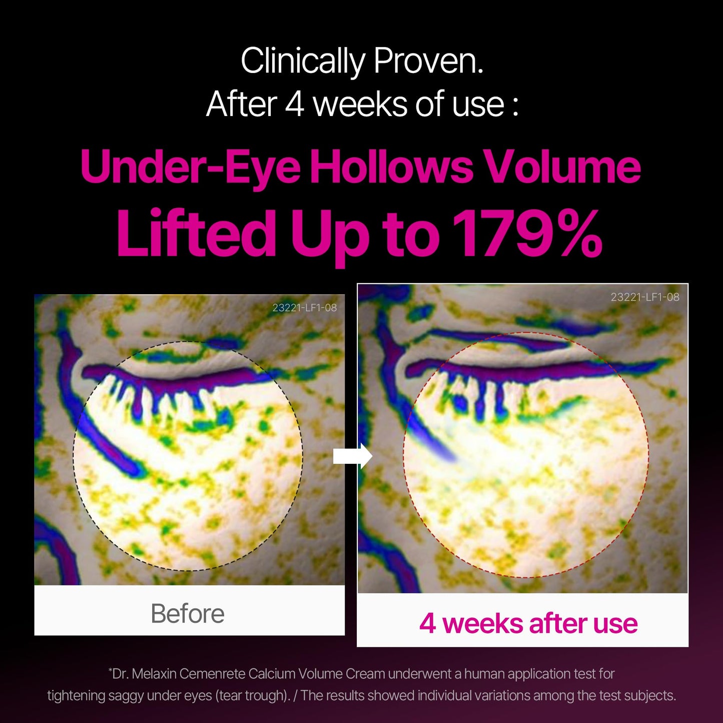 Dr.Melaxin Calcium Intense Firming Cream 50ml (1.69 fl oz) – Rebornic 10,000ppm, Niacinamide & Hydrolyzed Elastin - PrimeBioHealth - canada supplements