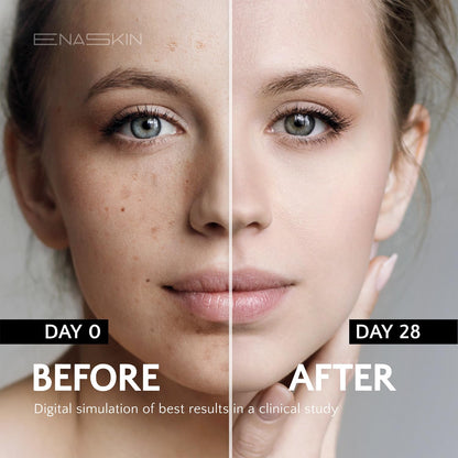EnaSkin Dark Spot Remover Face & Body Serum: Age Spot Sun Spot Freckles Melasma Brown Spot - PrimeBioHealth - canada supplements