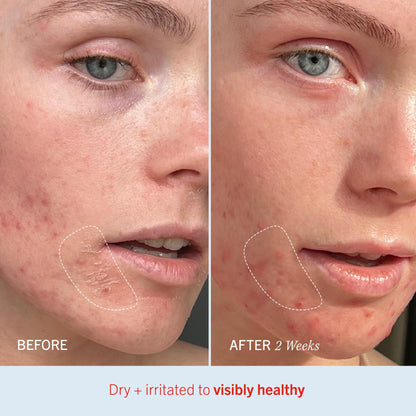 First Aid Beauty - Ultra Repair Cream, Intense Hydration Whipped Colloidal Oatmeal, Clinically Proven to Strengthen Skin Barrier in 7 Days - PrimeBioHealth - canada supplements