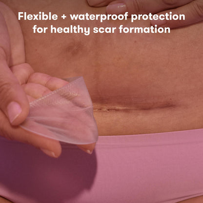 Frida Mom C-Section Silicone Strips, C-Section Recovery Must Have Scar Patches, Reusable Medical Grade Treatment - PrimeBioHealth - canada supplements