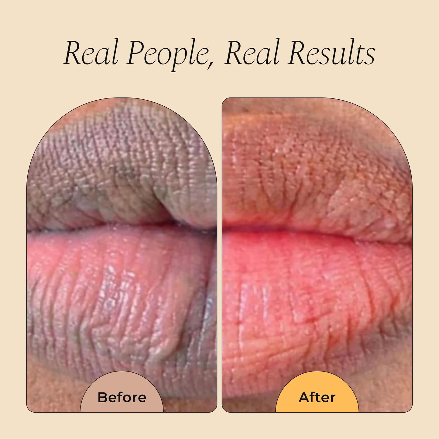 Glo Melanin All Natural Lemon and Turmeric Lip Balm - Natural Lip Balm Illuminate Your Smile - PrimeBioHealth - canada supplements
