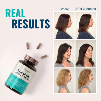 Hair La Vie Live Conscious Clinical Formula Hair Growth Vitamins for Women and Men w/Biotin, Collagen & Saw Palmetto (Pack of 1) - PrimeBioHealth - canada supplements