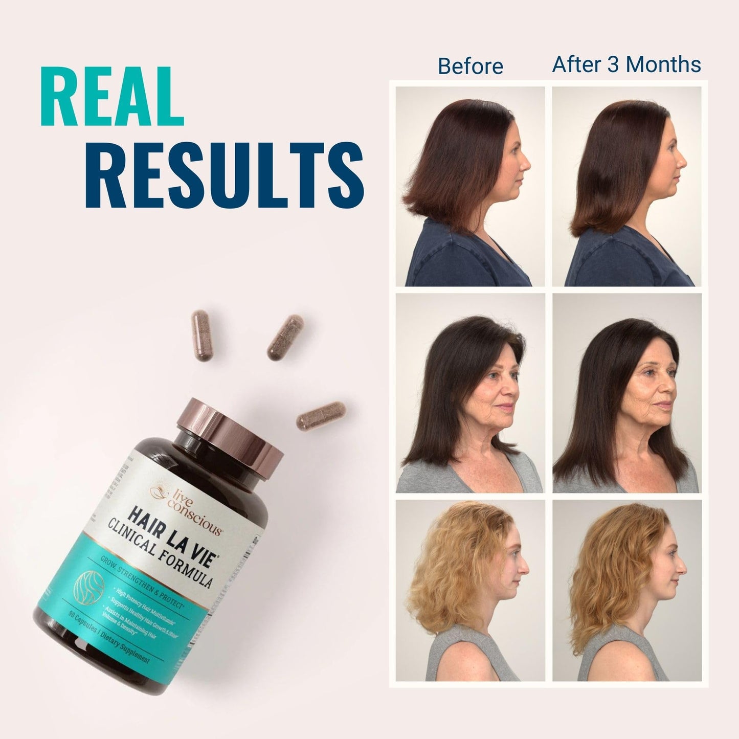 Hair La Vie Live Conscious Clinical Formula Hair Growth Vitamins for Women and Men w/Biotin, Collagen & Saw Palmetto (Pack of 1) - PrimeBioHealth - canada supplements