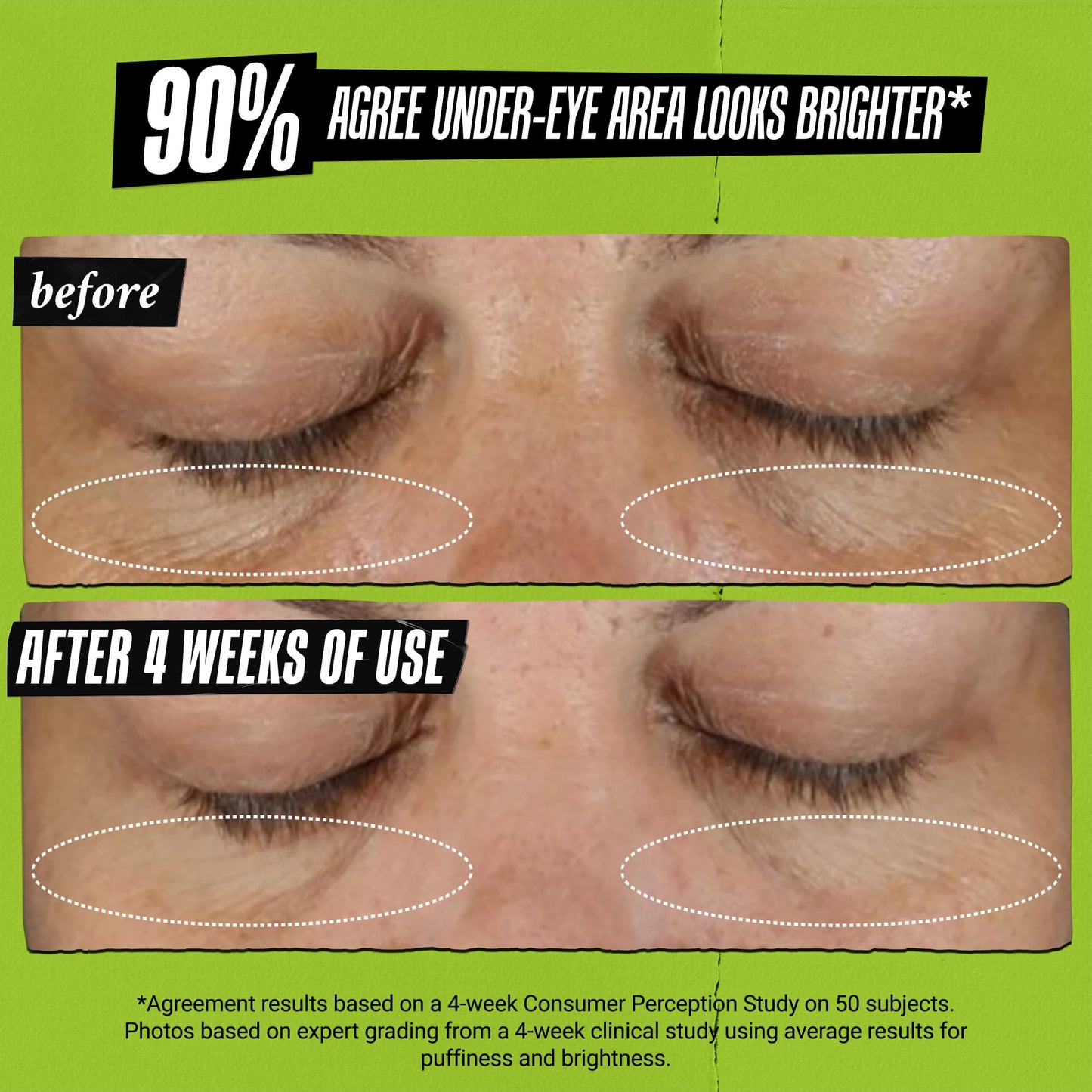 Kiehl's Avocado Eye Treatment, Nourishing and Hydrating Eye Cream, Avocado Oil and Caffeine to Energize and Invigorate Skin, Tired Eyes - PrimeBioHealth - canada supplements