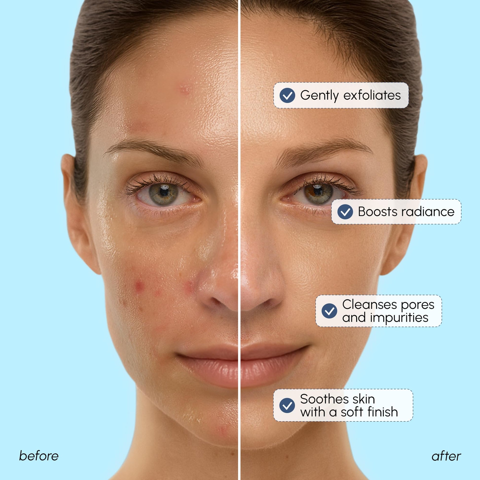 MAREE Face Exfoliator – Microdermabrasion Facial Scrub & Exfoliating Face Wash for Women – Collagen & Glycolic Acid – Gentle Scrub and Exfoliant - PrimeBioHealth - canada supplements