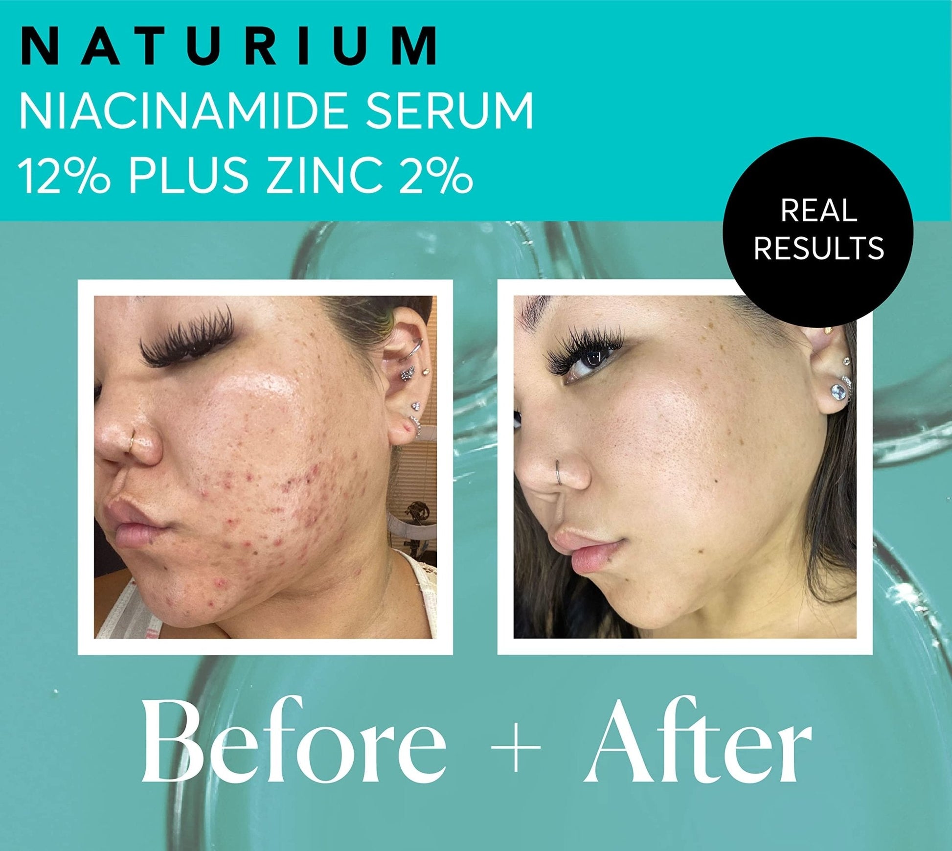 Naturium Niacinamide Face Serum 12% Plus Zinc 2%, Anti-Aging, Pore Minimizer & Dark Spot Corrector - PrimeBioHealth - canada supplements