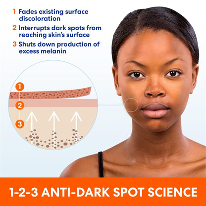 Palmer's Skin Success Anti-Dark Spot Fade Cream with Vitamin E and Niacinamide, for All Skin Types 2.7 Ounce - PrimeBioHealth - canada supplements