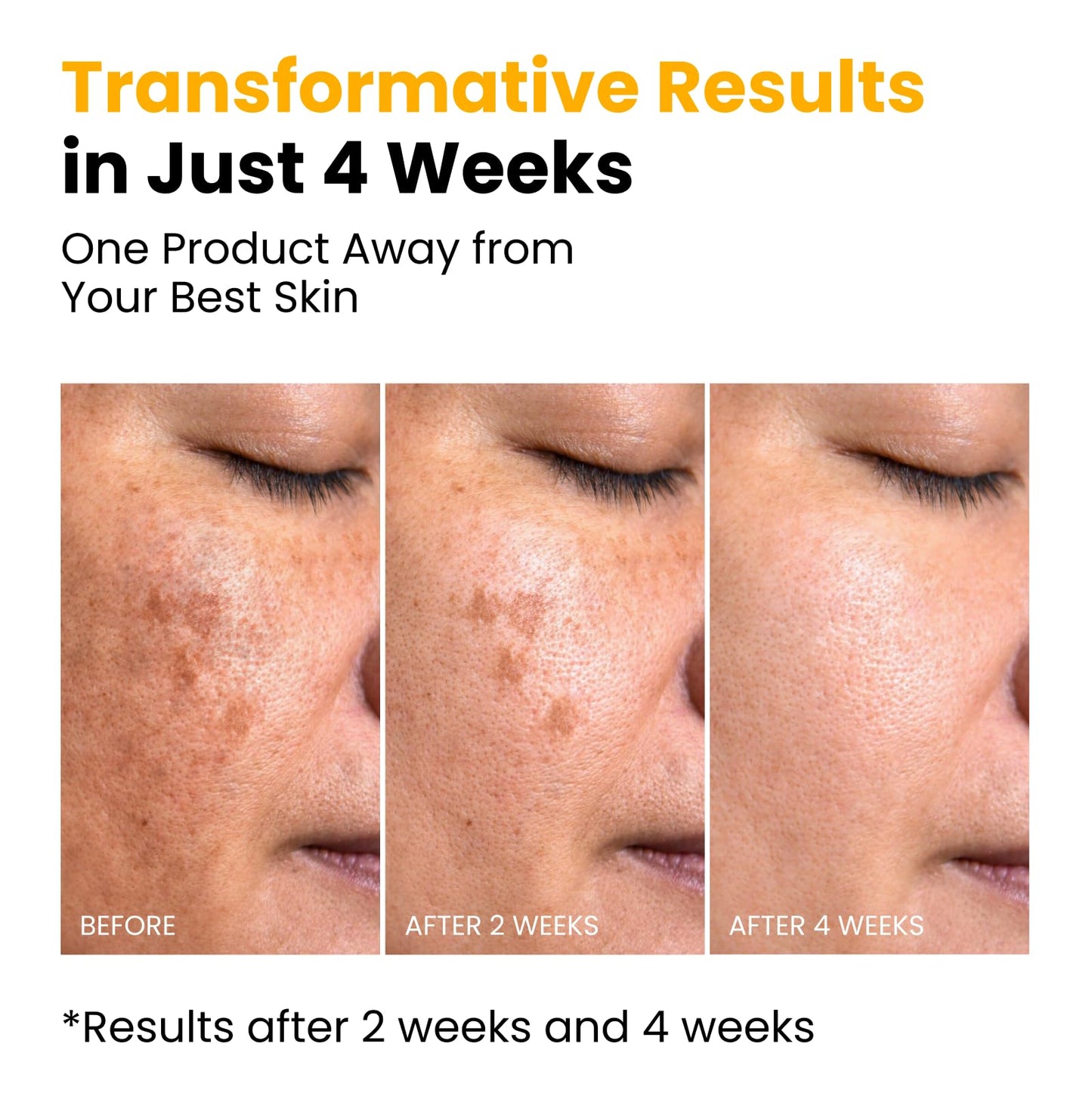 QUIA Turmeric + Kojic Acid Overnight Wrapping Mask – Hydration Mask for Glowing Skin - PrimeBioHealth - canada supplements