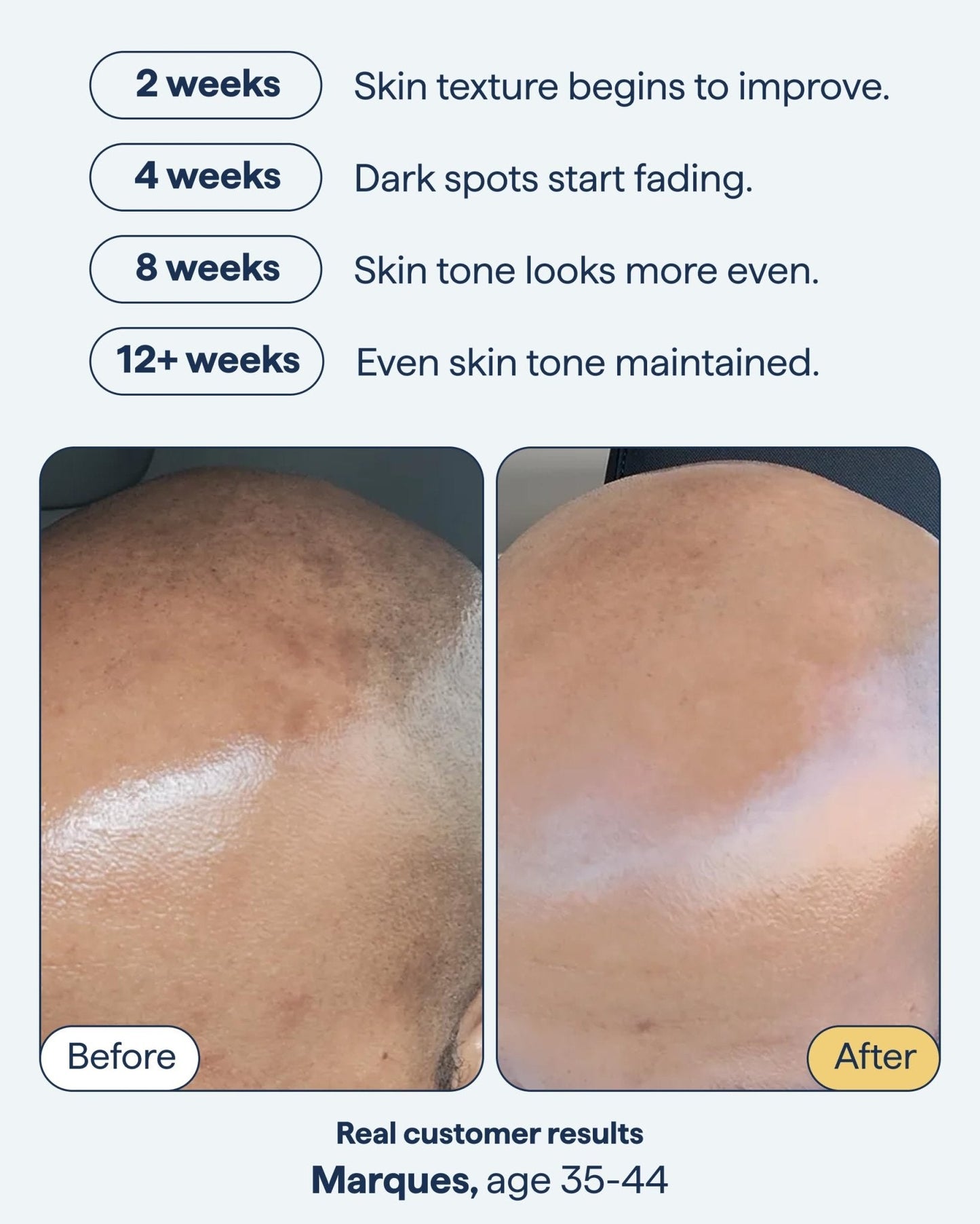 Remedy for Dark Spots | Advanced Night Treatment with Retinol & Kojic Acid | For Discoloration and Uneven Tones | With Glutathione - PrimeBioHealth - canada supplements