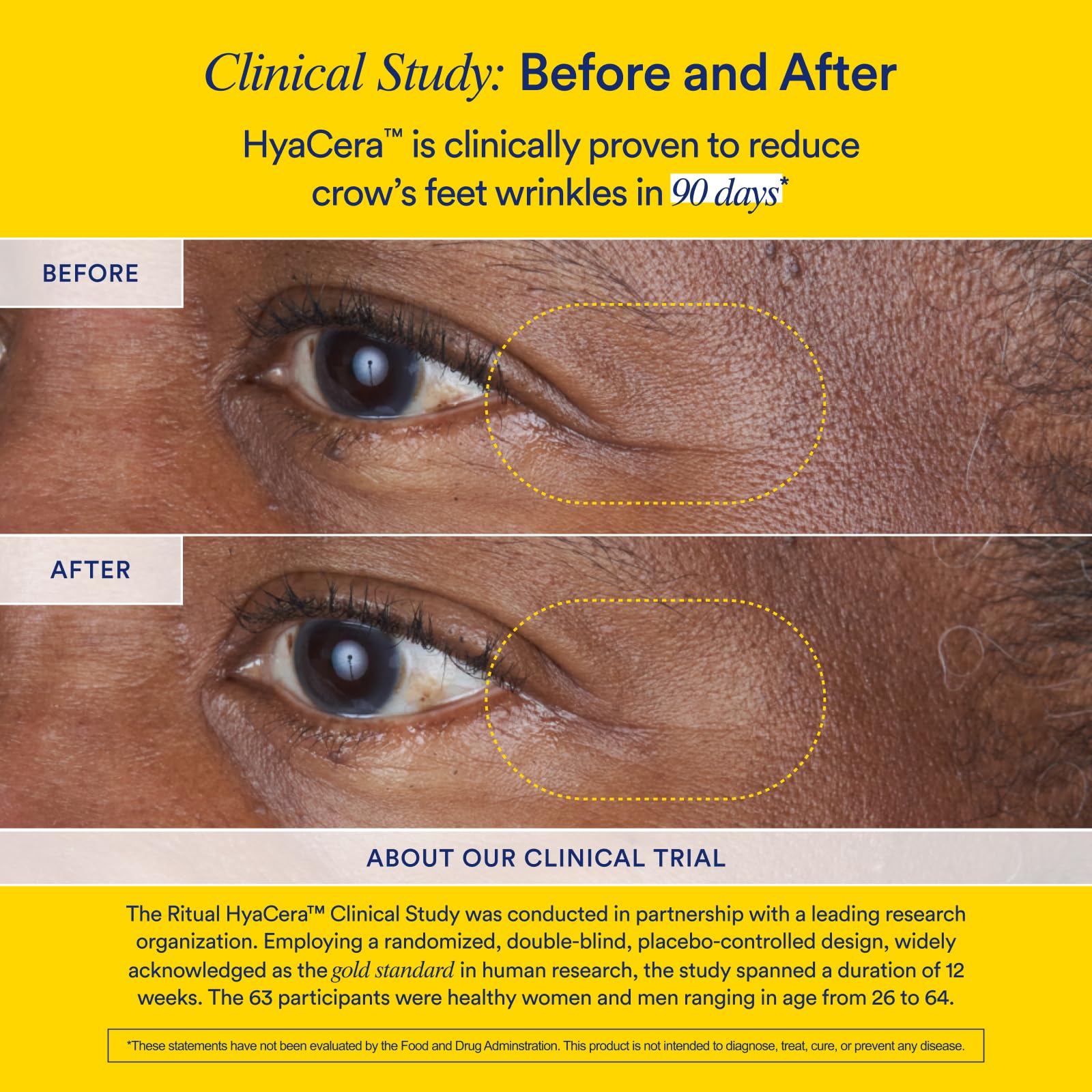 Ritual Hyaluronic Acid Skin Supplement - With Hyabest® and Ceratiq® - HyaCera Clinically Proven to Reduce Wrinkles, Fine Lines & Improve Skin Smoothness - PrimeBioHealth - canada supplements