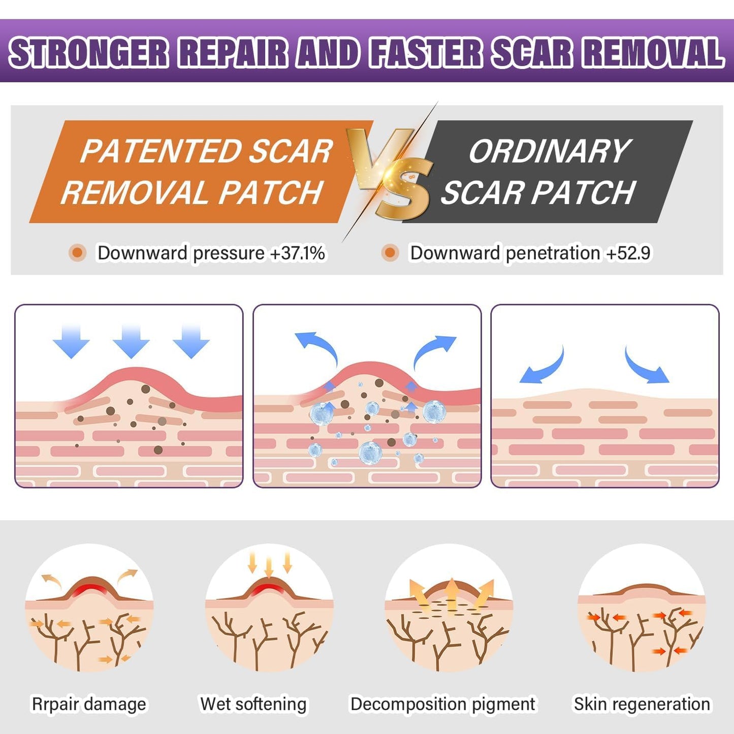 Silicone Scar Sheets,Silicone Scar Tape,Silicone Scar Removal Strips for Surgical,C-Section,Tummy Tuck,Keloid Scars - PrimeBioHealth - canada supplements