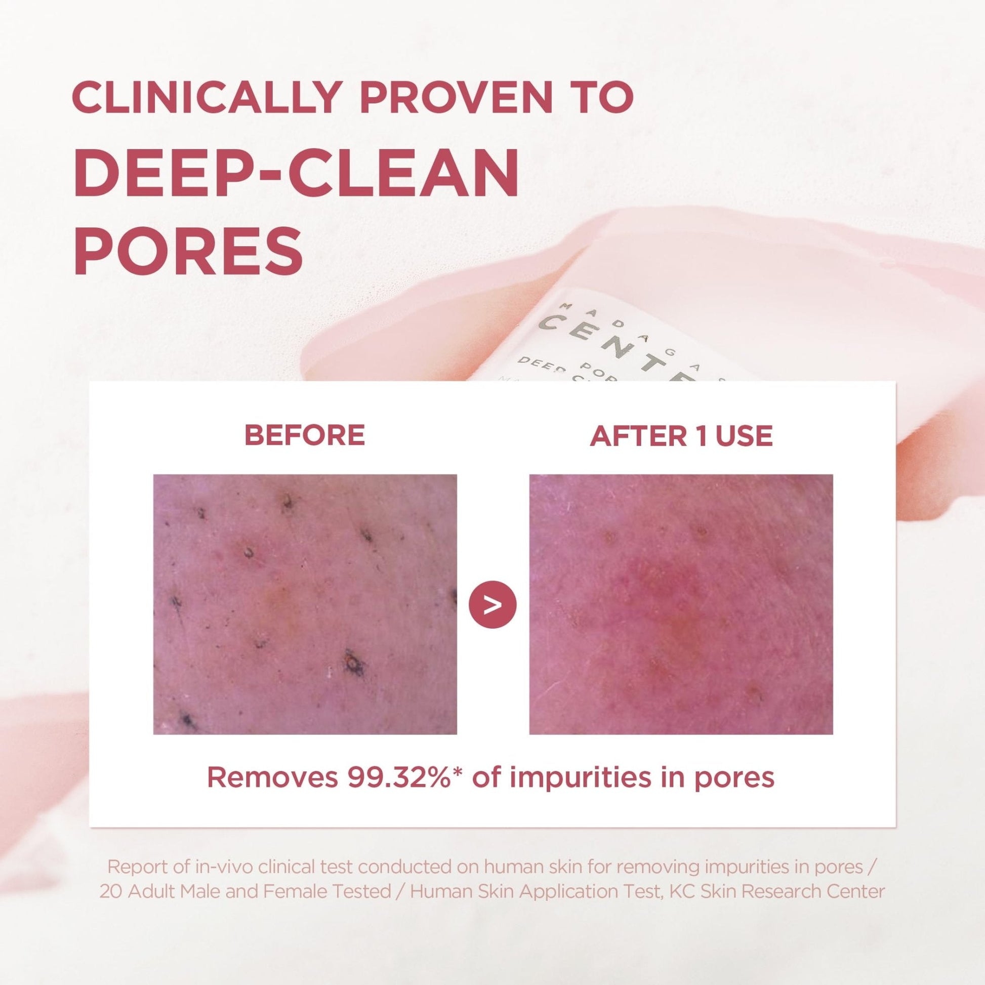 SKIN1004 Poremizing Deep Cleansing Foam, 4.23 fl.oz, 125ml, Makeup Remover, Korean Face Cleanser with Himalayan Pink Salt - PrimeBioHealth - canada supplements