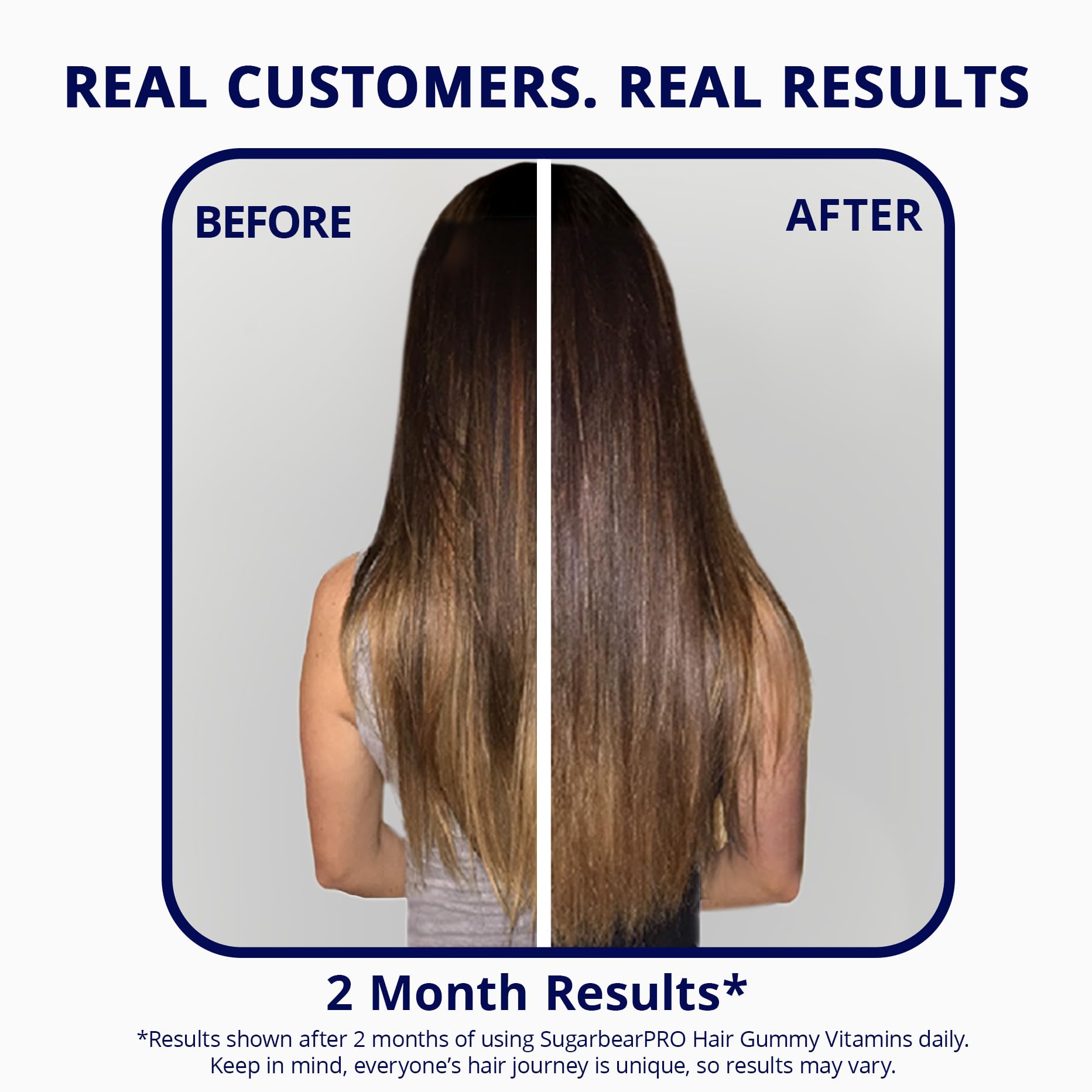 Sugarbear Hair Vitamin Gummy 2 Month Supply Extra Strength Biotin 6000mcg, Growth for Men & Women, Vegan Vitamin B12, MSM, Inositol, Omega 3, Elderberry, Certified Kosher, Halal, Cruelty-Free - PrimeBioHealth - canada supplements