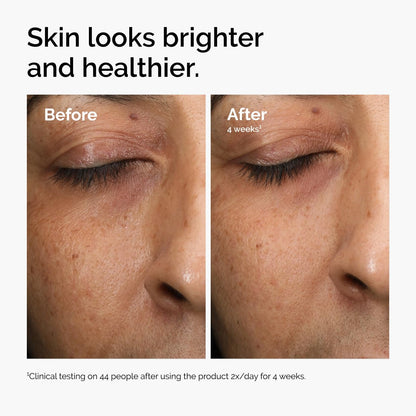 The Ordinary Multi-Antioxidant Radiance Serum, Vitamin C Serum For Face, Brighten & Protect Skin – Boosts Glow - PrimeBioHealth - canada supplements