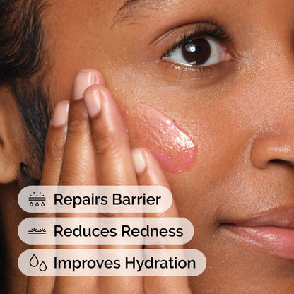 The Ordinary Soothing & Barrier Support Serum, Redness-Reducing & Hydrating Solution for Skin Barrier Recovery, 1 Fl Oz - PrimeBioHealth - canada supplements