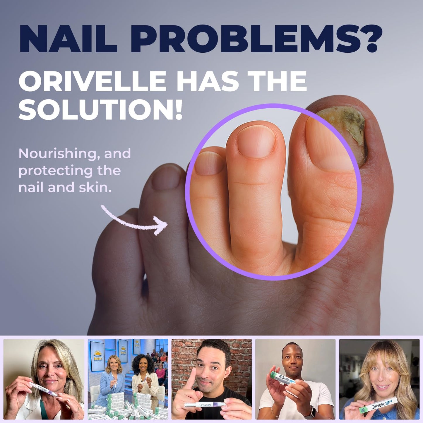 Toenail Care Pen - Extra Strength Toe Nail Remedy - Professional Nail Solution for Fingernail with Tea Tree Oil (Pack of 4) - PrimeBioHealth - canada supplements