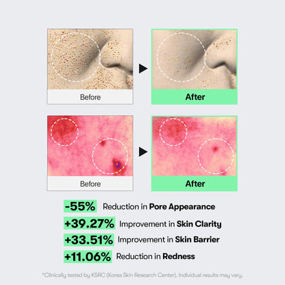 VT COSMETICS CICA Reedle Shot 100, Spicule Microneedling Serum for Pore Care & Exfoliation, Exosome, Centella Asiatica for Glass Skin - PrimeBioHealth - canada supplements