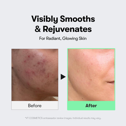 VT COSMETICS CICA Reedle Shot 100, Spicule Microneedling Serum for Pore Care & Exfoliation, Exosome, Centella Asiatica for Glass Skin - PrimeBioHealth - canada supplements
